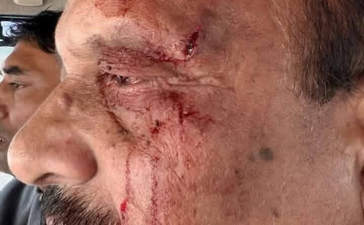 प्रारंभिक शिक्षा निदेशक ने विधायक पर लगाए गंभीर आरोप, रायपुर थाने में एफआईआर दर्ज