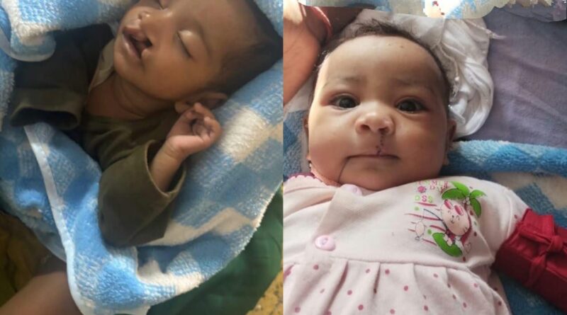 राष्ट्रीय बाल स्वास्थ्य कार्यक्रम से नौ बच्चों को मिला नया जीवन, निशुल्क हुई सर्जरी